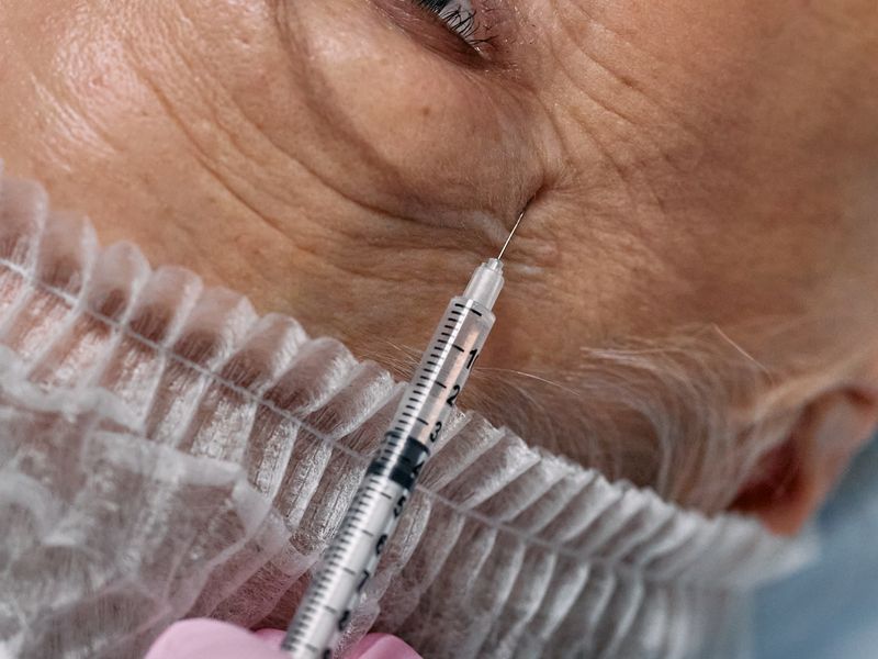 Vitaran Eyes under-eye rejuvenation treatment at Regener8 Aesthetics, Selly Oak, Birmingham